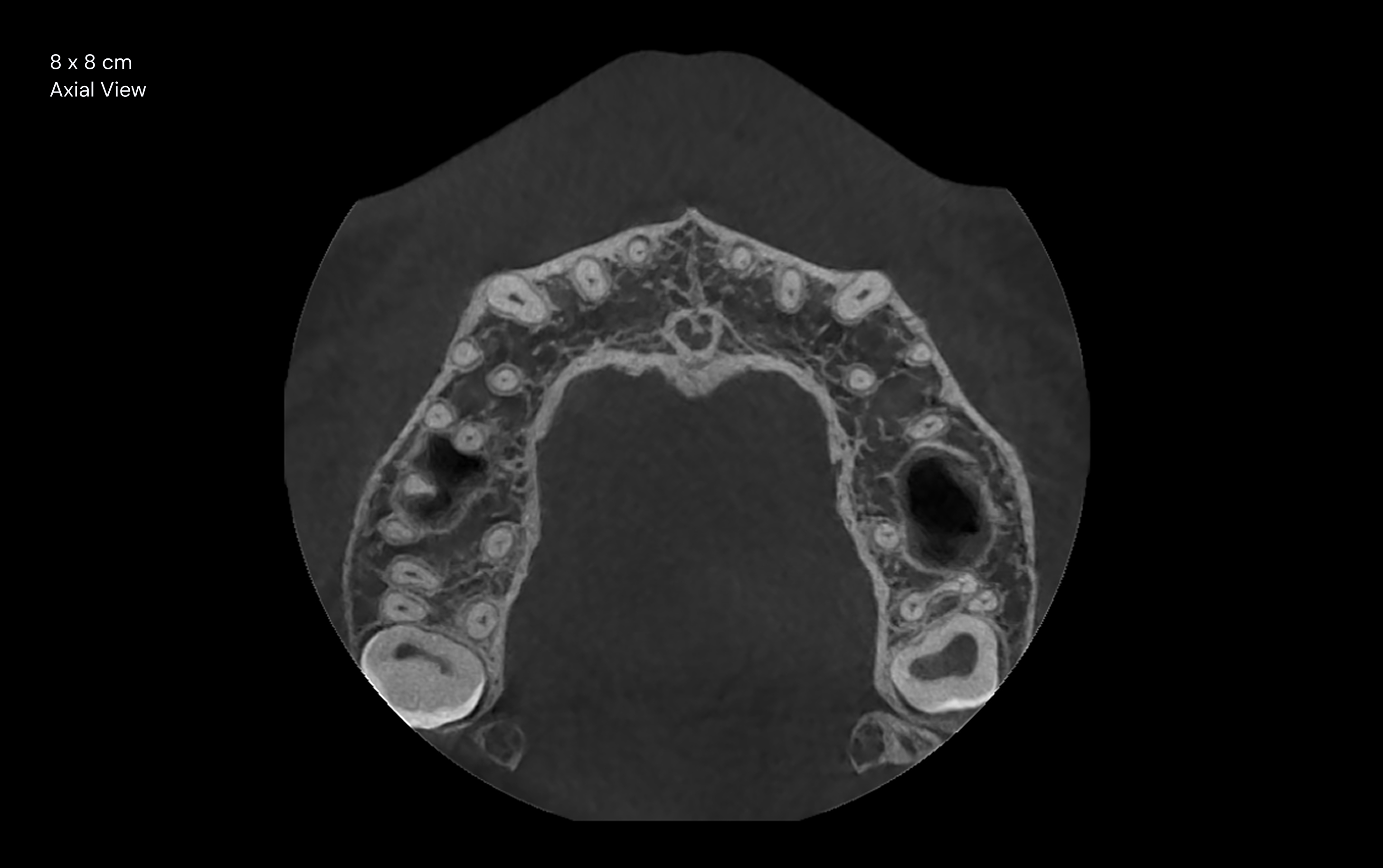 8 x 8 cm Axial View